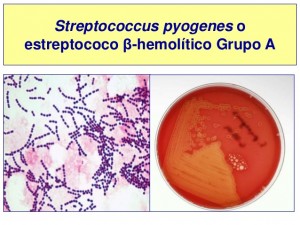 estreptococcus-15-638